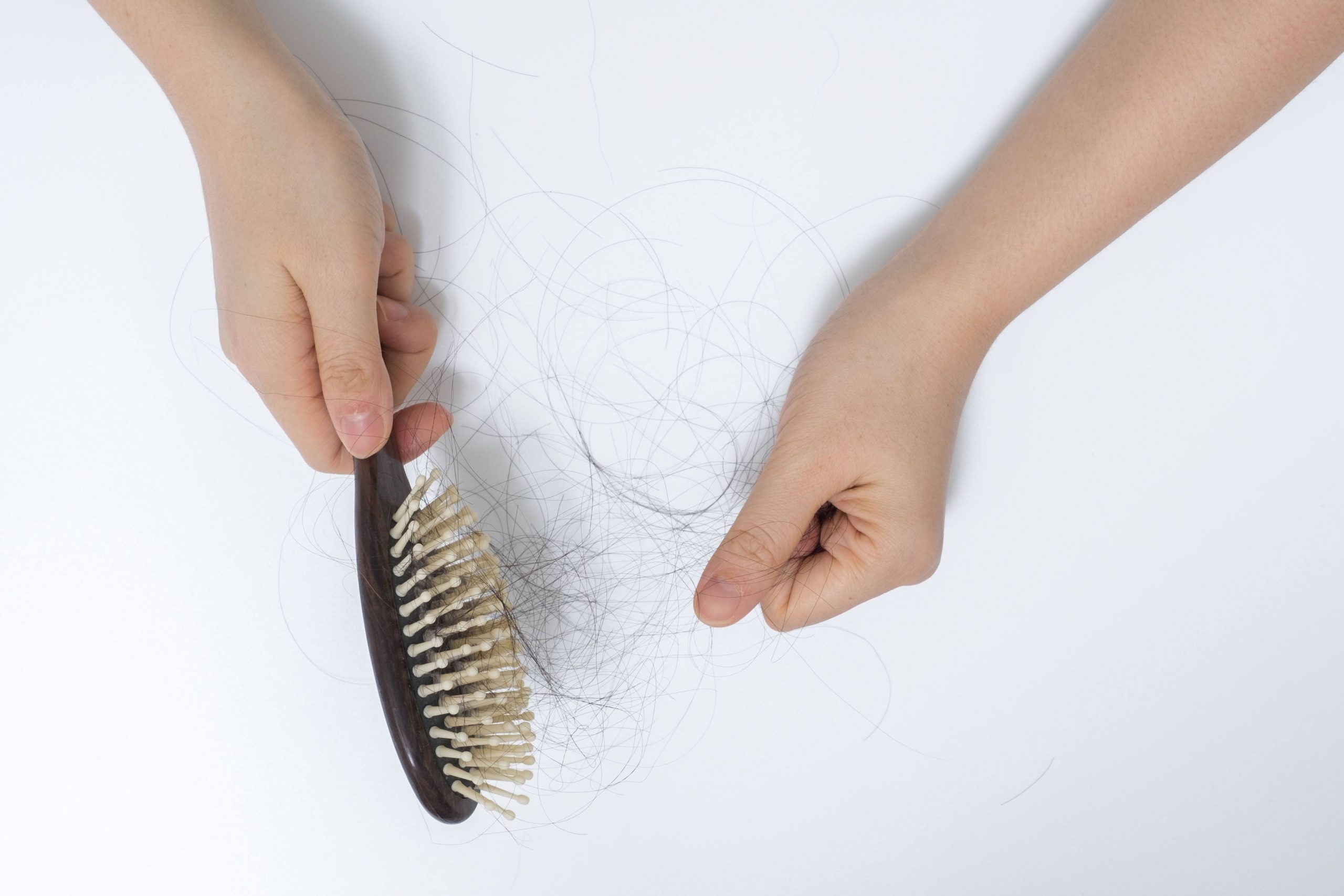 Queda de cabelo afeta homens e mulheres de modo diferente
