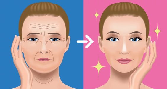 imagem ilustrativa de antes e depois de um preenchimento facial