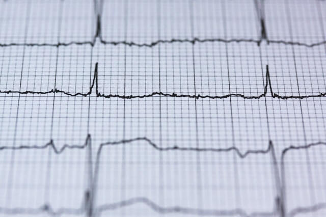 Exame cardíaco para cirurgia plástica