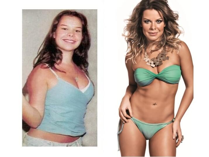 Antes e depois das cirurgias plásticas