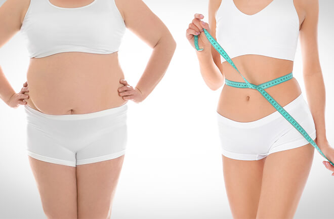 duas mulheres uma ao lado da outra representando o ganho de peso e a perda de peso