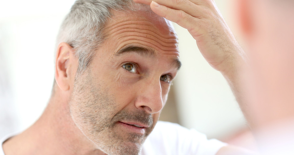 Cabelo e autoestima: perda de cabelo interfere no bem-estar