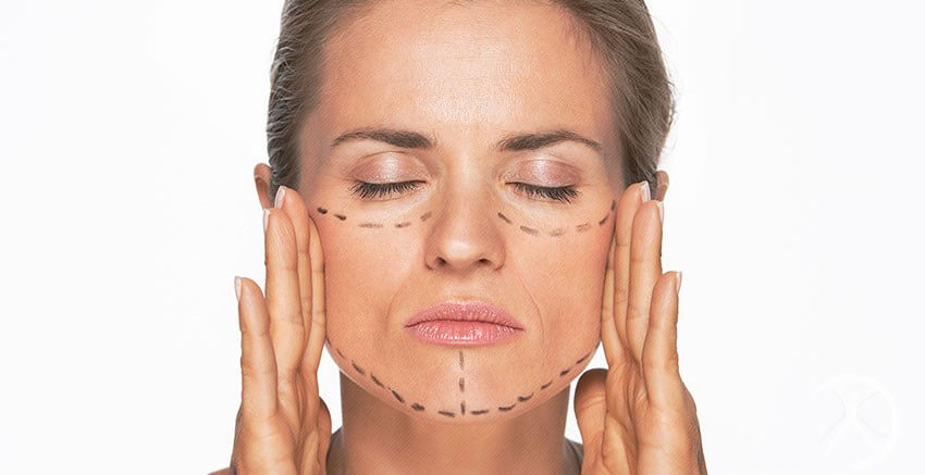 Mulher com a mão no rosto e marcações para uma Cirurgia plástica