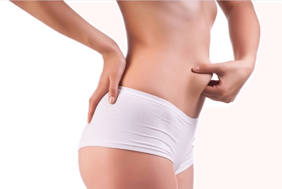 Mulher segurando o excesso de pele na barriga após a lipoaspiração