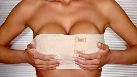 Mulher com as mãos abaixo dos seios recém operados após um Aumento de mamas