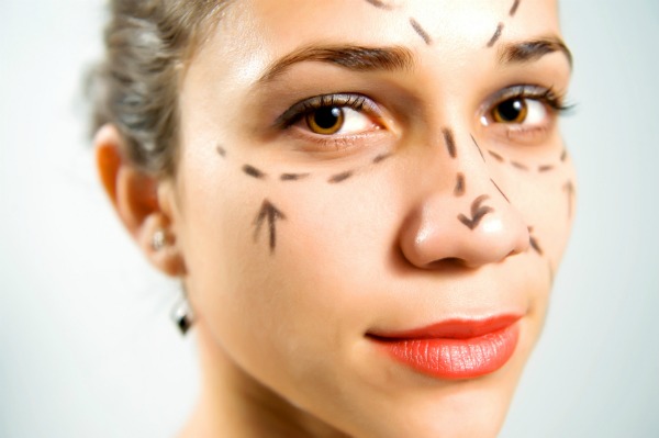 Adolescente com as marcações no rosto para cirurgias plásticas.