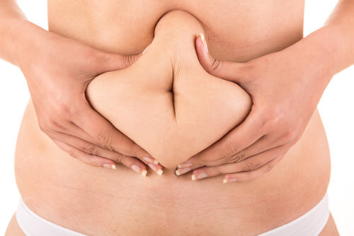 Retirando a flacidez da barriga com a mini abdominoplastia