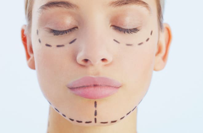 mulher realizando cirurgia plastica no rosto 