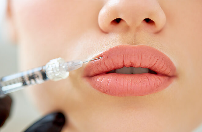 mulher aplicando toxína botulínica nos lábios