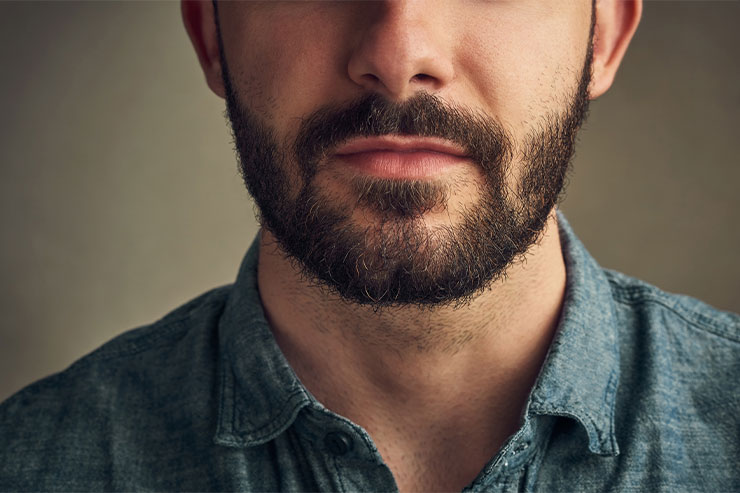 confira os métodos de transplante de barba para corrigir falhas de forma definitiva!