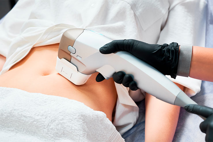 conheça o ultrassom microfocado e como ele ajuda na flacidez